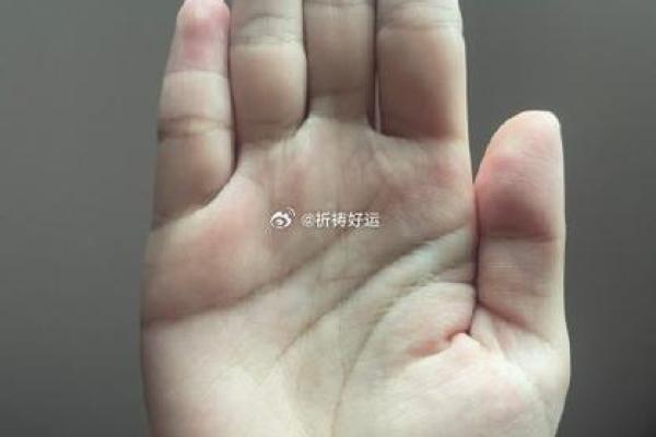 胳膊长黑毛？你的命运密码隐藏在这里，如何解锁人生新局