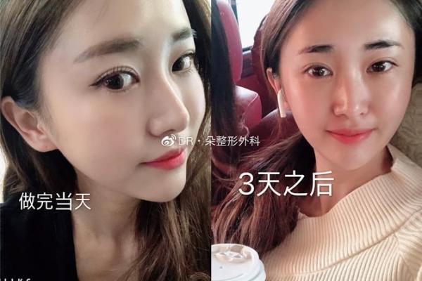 如何改变命运：颈纹与八字的神秘联系